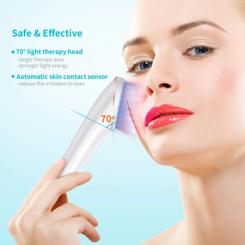 Wireless Acne Eraser