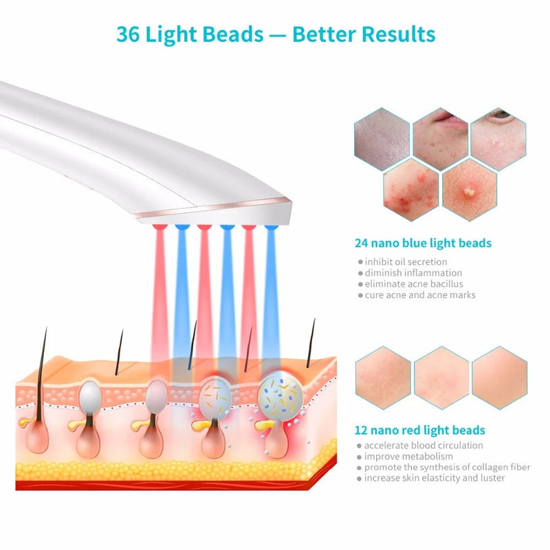 Wireless Acne Eraser